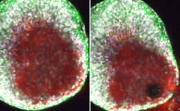 Une vidéo inédite révèle un ovule "éclatant" des ovaires au cours de l'ovulation - ce qui explique certainement la douleur.