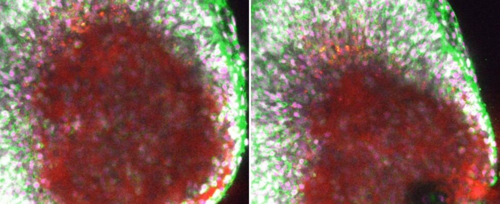 Une vidéo inédite révèle un ovule "éclatant" des ovaires au cours de l'ovulation - ce qui explique certainement la douleur.