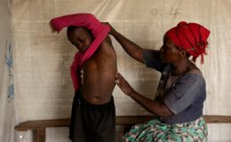 Mpox : Une nouvelle variante en Afrique centrale et des cas signalés en Europe, tout ce qu'il faut savoir sur cette épidémie.