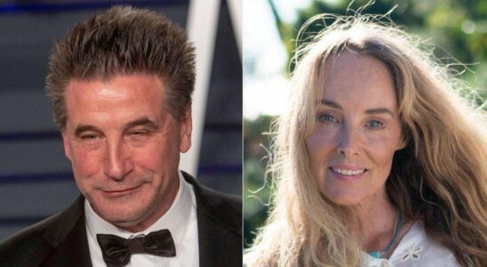 Chynna Phillips révèle sa séparation avec Billy Baldwin : une "allergie" mutuelle dévoilée