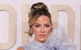 Exploration des enjeux de santé de Kate Beckinsale : de son hospitalisation en 2021 aux mystérieuses ecchymoses récentes