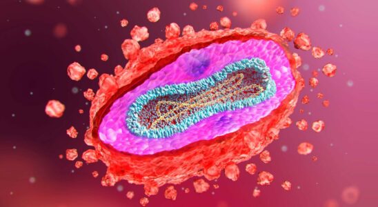 Découverte des symptômes négligés de l'impox avec un cinquième cas mortel signalé au Royaume-Uni