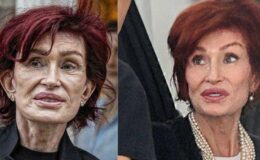 Sharon Osbourne profondément affectée par des photos manipulées la présentant comme un 'squelette zombie' tout en luttant contre une perte de poids 'mortelle' causée par l'Ozempic.