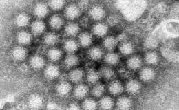 Norovirus : recommandations médicales face à la montée des épidémies et des maladies