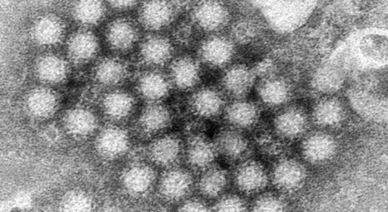 Norovirus : recommandations médicales face à la montée des épidémies et des maladies