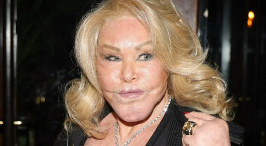 Le parcours tragique de Jocelyn Wildenstein : de la blonde dénudée aux dangers de l'obsession chirurgicale sous la pression de son mari armé.