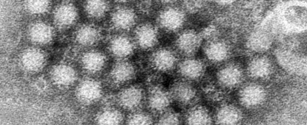 Alerte santé publique : une nouvelle souche de norovirus suscite des inquiétudes